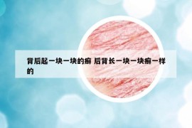 背后起一塊一塊的癬 后背長(zhǎng)一塊一塊癬一樣的