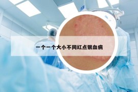 一個(gè)一個(gè)大小不同紅點(diǎn)銀血病