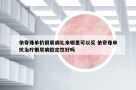 依奇珠單抗銀屑病禮來(lái)哪里可以買(mǎi) 依奇珠單抗治療銀屑病穩(wěn)定性好嗎