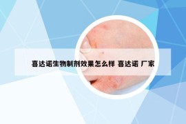 喜達諾生物制劑效果怎么樣 喜達諾 廠家