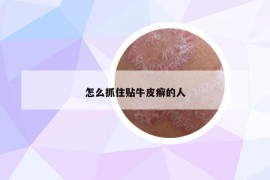 怎么抓住貼牛皮癬的人