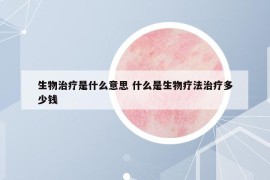 生物治療是什么意思 什么是生物療法治療多少錢