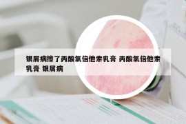 銀屑病擦了丙酸氯倍他索乳膏 丙酸氯倍他索乳膏 銀屑病
