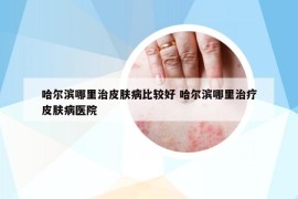 哈爾濱哪里治皮膚病比較好 哈爾濱哪里治療皮膚病醫(yī)院