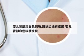 嬰兒背部淡白色斑塊,斑塊邊緣有皮屑 嬰兒背部白色塊狀皮膚