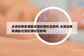 點(diǎn)滴妝銀屑病能吃德欣康松花粉嗎 點(diǎn)滴妝銀屑病能吃德欣康松花粉嗎