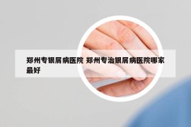 鄭州專銀屑病醫(yī)院 鄭州專治銀屑病醫(yī)院哪家最好