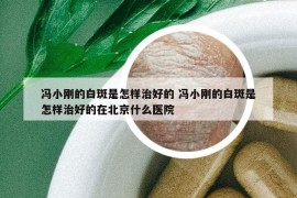 馮小剛的白斑是怎樣治好的 馮小剛的白斑是怎樣治好的在北京什么醫(yī)院