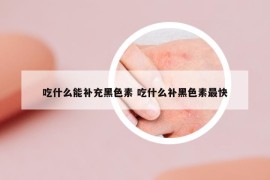 吃什么能補充黑色素 吃什么補黑色素最快