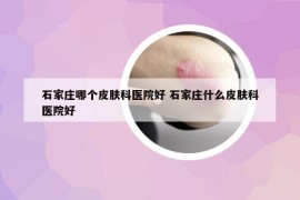 石家莊哪個(gè)皮膚科醫(yī)院好 石家莊什么皮膚科醫(yī)院好