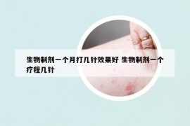 生物制劑一個月打幾針效果好 生物制劑一個療程幾針