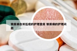 銀屑病合并壓瘡的護(hù)理查房 銀屑病的護(hù)理問(wèn)題
