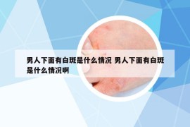 男人下面有白斑是什么情況 男人下面有白斑是什么情況啊