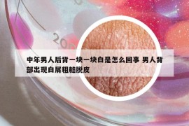中年男人后背一塊一塊白是怎么回事 男人背部出現(xiàn)白屑粗糙脫皮
