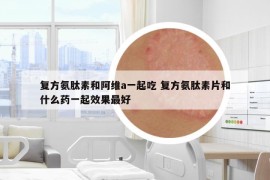 復(fù)方氨肽素和阿維a一起吃 復(fù)方氨肽素片和什么藥一起效果最好