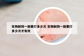 生物制劑一般要打多少次 生物制劑一般要打多少次才有效