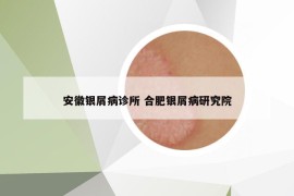 安徽銀屑病診所 合肥銀屑病研究院
