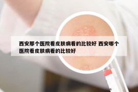 西安那個(gè)醫(yī)院看皮膚病看的比較好 西安哪個(gè)醫(yī)院看皮膚病看的比較好