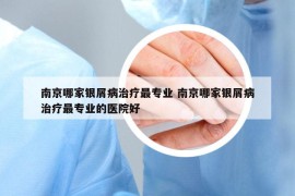南京哪家銀屑病治療最專業(yè) 南京哪家銀屑病治療最專業(yè)的醫(yī)院好