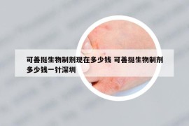 可善挺生物制劑現(xiàn)在多少錢 可善挺生物制劑多少錢一針深圳