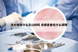 皮好癬有什么忌口的嗎 皮癬患者吃什么調(diào)理?