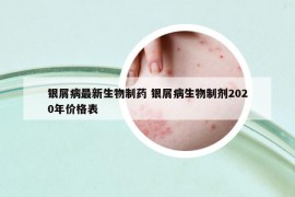 銀屑病最新生物制藥 銀屑病生物制劑2020年價(jià)格表