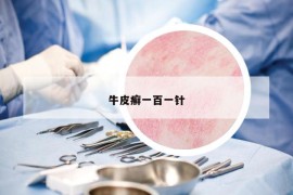 牛皮癬一百一針