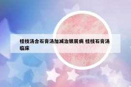 桂枝湯合石膏湯加減治銀屑病 桂枝石膏湯 臨床