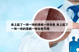 身上起了一塊一塊的像癬一樣白色 身上起了一塊一塊的像癬一樣白色不癢