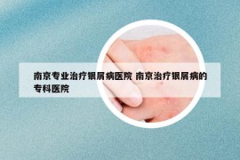 南京專(zhuān)業(yè)治療銀屑病醫(yī)院 南京治療銀屑病的專(zhuān)科醫(yī)院