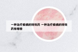 一種治療癬病的特效藥 一種治療癬病的特效藥有哪些