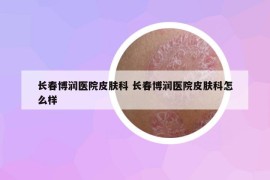 長春博潤醫(yī)院皮膚科 長春博潤醫(yī)院皮膚科怎么樣