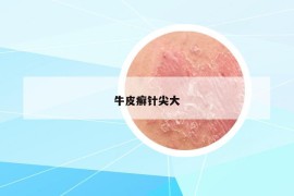 牛皮癬針尖大