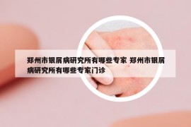 鄭州市銀屑病研究所有哪些專家 鄭州市銀屑病研究所有哪些專家門診