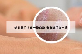 幼兒腦門上有一塊白塊 寶寶腦門白一塊