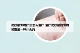 皮膚病生物療法怎么治療 治療皮膚病的生物試劑是一種什么藥