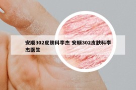安順302皮膚科李杰 安順302皮膚科李杰醫(yī)生