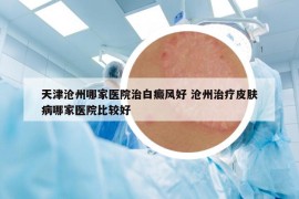 天津滄州哪家醫(yī)院治白癜風(fēng)好 滄州治療皮膚病哪家醫(yī)院比較好