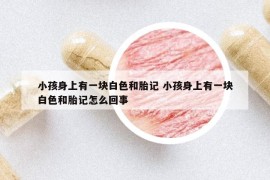 小孩身上有一塊白色和胎記 小孩身上有一塊白色和胎記怎么回事