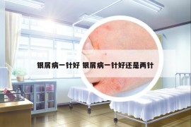 銀屑病一針好 銀屑病一針好還是兩針