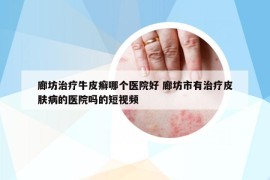 廊坊治療牛皮癬哪個(gè)醫(yī)院好 廊坊市有治療皮膚病的醫(yī)院?jiǎn)岬亩桃曨l