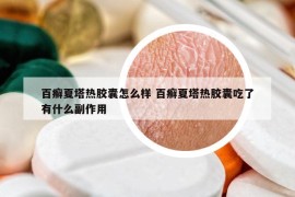 百癬夏塔熱膠囊怎么樣 百癬夏塔熱膠囊吃了有什么副作用