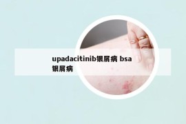 upadacitinib銀屑病 bsa 銀屑病