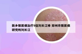 新鄉(xiāng)銀屑病治療9信劉長江棒 鄭州市銀屑病研究所劉長江