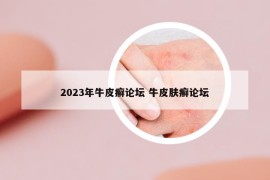 2023年牛皮癬論壇 牛皮膚癬論壇