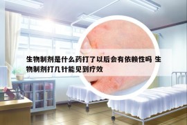 生物制劑是什么藥打了以后會有依賴性嗎 生物制劑打幾針能見到療效