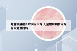 兒童銀屑病長時間治不好 兒童銀屑病有治好后不復(fù)發(fā)的嗎