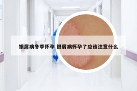 銀屑病冬季懷孕 銀屑病懷孕了應該注意什么