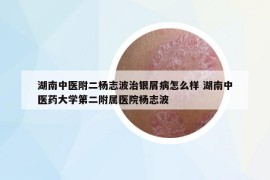 湖南中醫(yī)附二楊志波治銀屑病怎么樣 湖南中醫(yī)藥大學第二附屬醫(yī)院楊志波