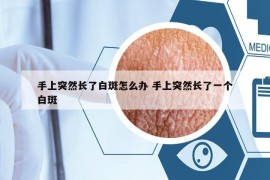 手上突然長了白斑怎么辦 手上突然長了一個白斑